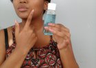 lipidol results