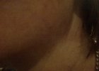 Neck 6 Nov.jpg