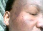 Thats afta Clarins Range. i was worse than this.