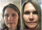 #changeyourskin.jpg
