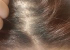 Regrowth