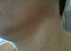 Neck - After.jpg