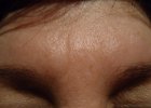 AFTER 4 WEEKS