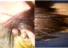 My tips, Before and After