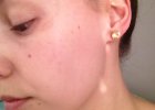 Clarins Bright Plus Serum: BEFORE