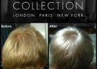 My Brother&#039;s Before and After