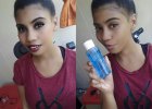 Lipidol before and after
