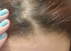 My roots