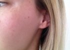 Clarins Bright Plus Serum: AFTER