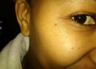 Dry and tired skin arond the eyes...