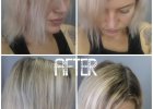 before and after