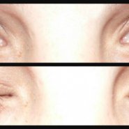 MD Lash Factor, Eye Lash Conditioner