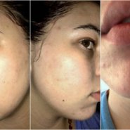Dermaceutic Skincare