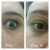 Clarins Super Restorative Total Eye Concentrate