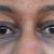 L&#039;Oreal Paris Skin Perfection Anti-fatigue Eye Awakening + Correcting Cream
