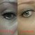 Vichy LiftActiv Serum 10 Supreme - 1 Month Results