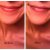 Abeeco Bee Venom Lip Plumper