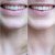 Listerine Advanced White Multi-Action Mouthwash