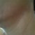 Neck - After.jpg