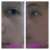 Kiehl&#039;s Dermatologist Solutions™  Clearly Corrective Dark Spot Solution