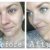 Kiehl&#039;s Dermatologist Solutions™  Clearly Corrective Dark Spot Solution