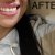 Listerine review