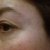 Eye - Before.jpg