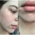 Dermaceutic Skincare