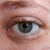 Eye Before Picture.JPG
