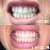 1 week in!