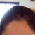 after.jpg