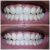 Listerine Advanced White Multi-Action Mouthwash