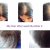 Nioxin Hair System Kit 2- Noticeably Thinning Hair