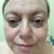 Skin Results after applying Justine 3 Step Hydrating Range.Smooth and moisterised but a little red.