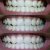 Listerine Advanced White Multi-Action Mouthwash