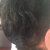 Before Treatment (greys are visible)