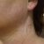 Before - Neck.jpg