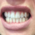 Before Using Listerine Advanced White Mouthwash