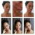POND&#039;S Pimple Clear Micellar Water