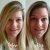 Vichy LiftActiv Serum 10 Supreme - 10 Day Results