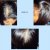 Nioxin Hair System Kit 2- Noticeably Thinning Hair