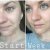 Kiehl&#039;s Dermatologist Solutions Hydro-Plumping Retexturing Serum Concentrate