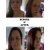 My Before &amp; After