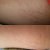 Before and after a week