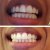 Listerine Advanced White Multi-Action Mouthwash