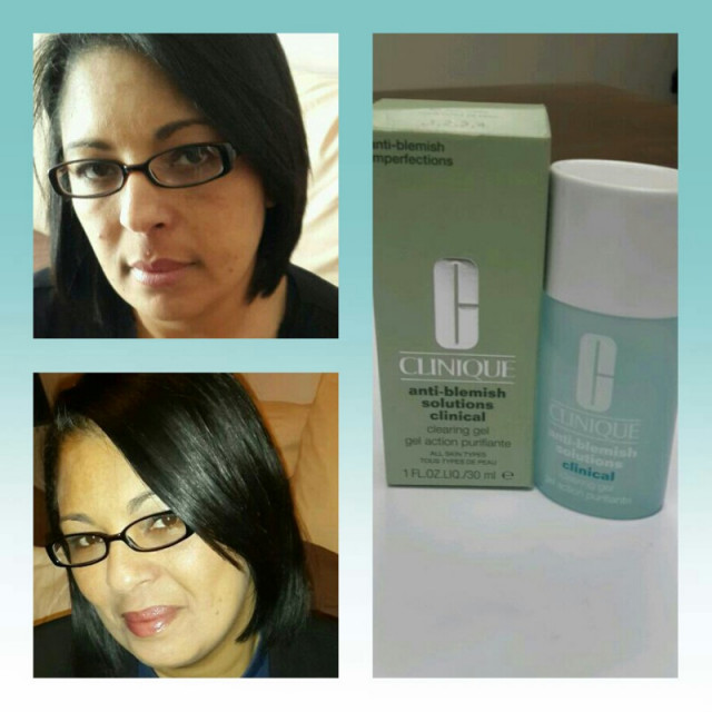 Anti Blemish Solution by Clinique