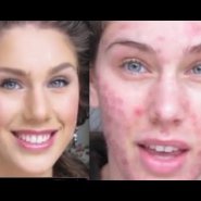 Foundation Routine Flawless Skin (Full Coverage Tutorial) Cystic Acne &amp; Scaring Diamondsandheels14
