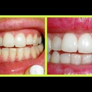 Natural DIY Teeth Whitener!