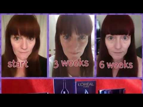 L&#039;oreal Filler Renew 6 Week Results