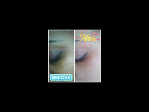 AVROY SHLAIN ANTI PIGMENTATION SERUM|| HIT OR MISS REVIEW|| BEAUTY BULLETIN
